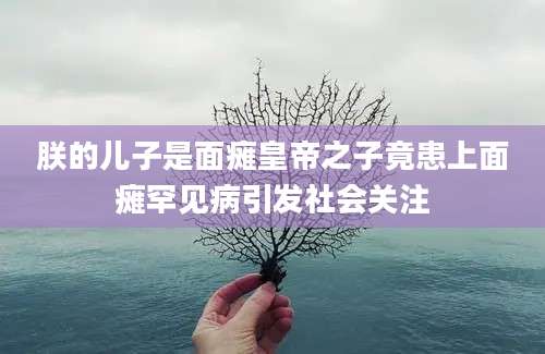 朕的儿子是面瘫皇帝之子竟患上面瘫罕见病引发社会关注