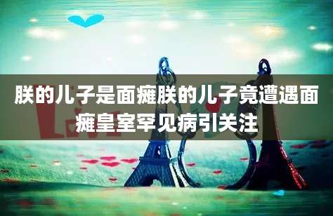 朕的儿子是面瘫朕的儿子竟遭遇面瘫皇室罕见病引关注